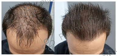 Tinfal Plus Solution 60ml