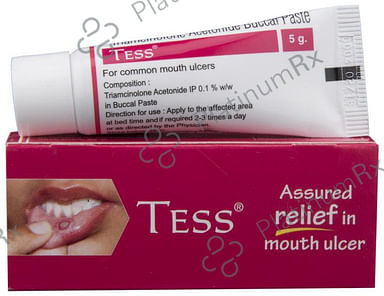 Tess 0.1% Oral Paste 5gm