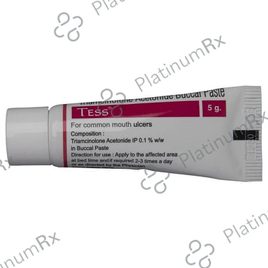 Tess 0.1% Oral Paste 5gm