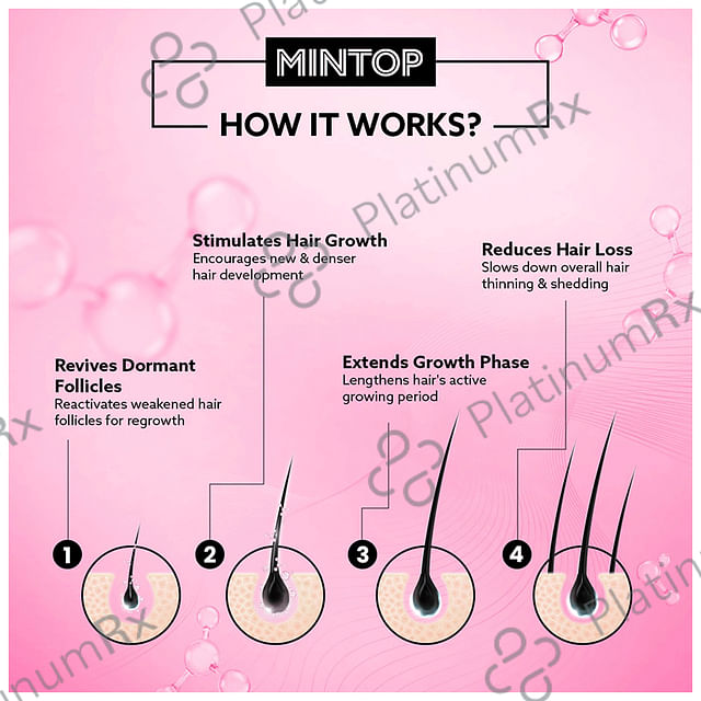 Mintop Forte 2% Hair Restore Formula Solution 60ml